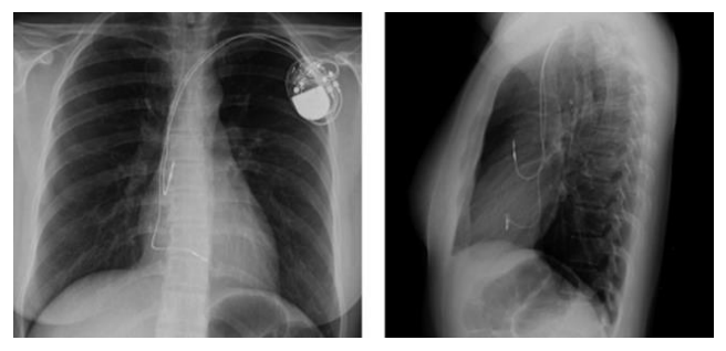 Figura da questão de Cardiologia