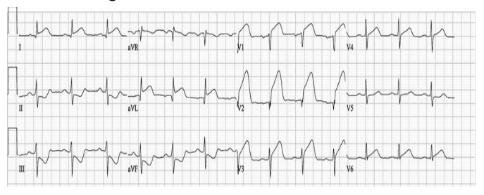 Figura da questão de Cardiologia