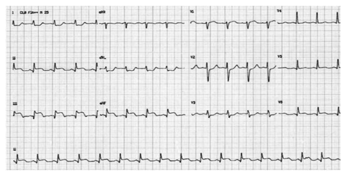 Figura da questão de Cardiologia