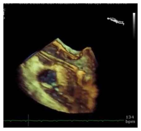 Figura da questão de Ecocardiografia