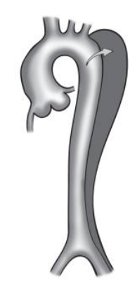 Figura da questão de Cardiologia
