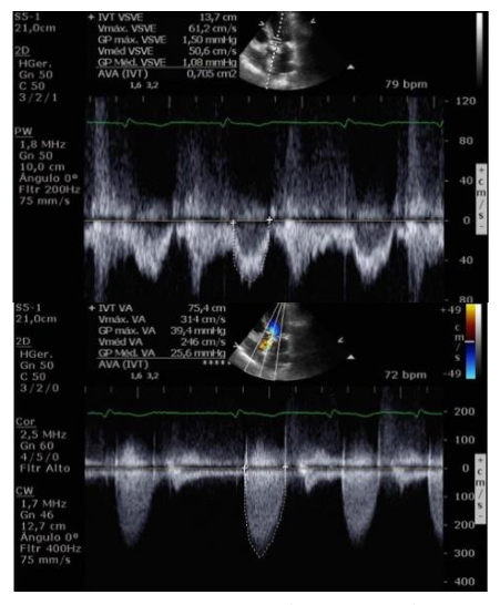 Figura da questão de Ecocardiografia