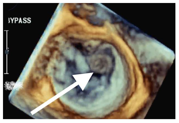 Figura da questão de Ecocardiografia