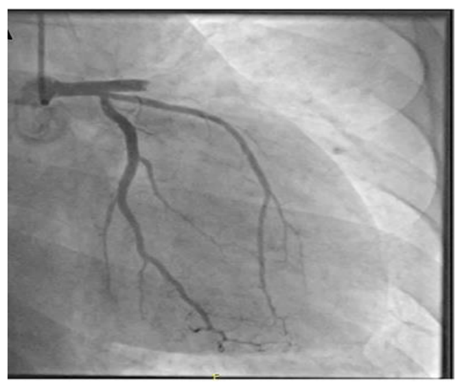 Figura da questão de Cardiologia