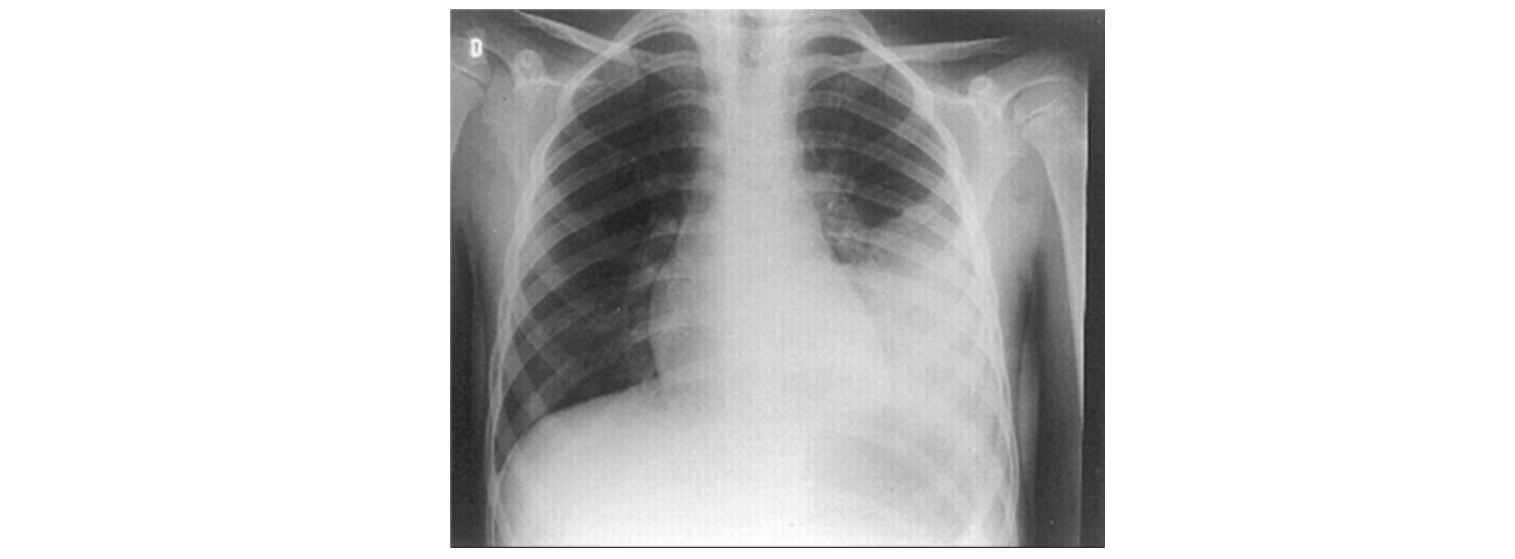 Figura da questão de Medicina