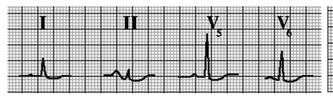 Figura da questão de Medicina (Cardiologia)