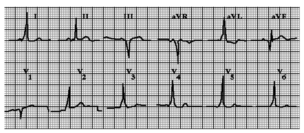 Figura da questão de Medicina (Cardiologia)