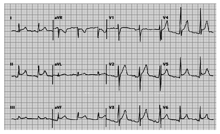 Figura da questão de Medicina (Cardiologia)