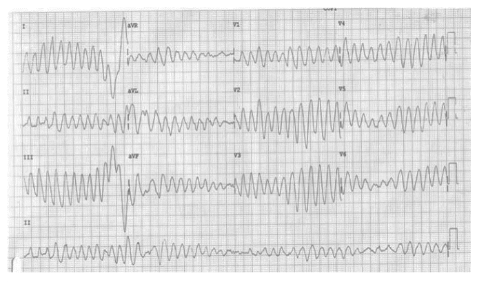 Figura da questão de Cardiologia