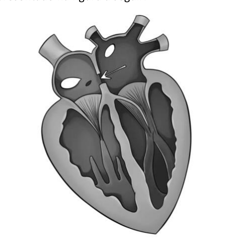 Figura da questão de Cardiologia