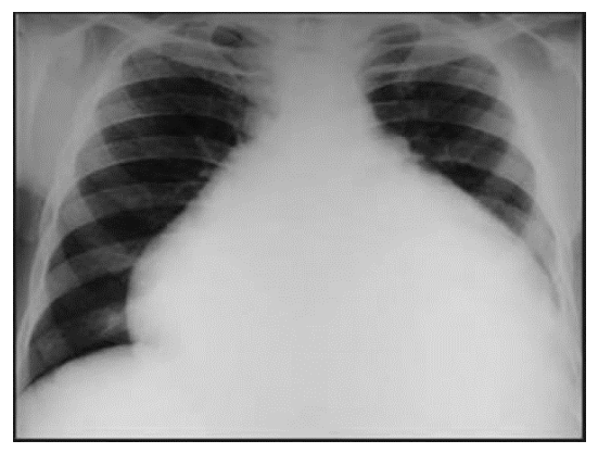 Figura da questão de Cardiologia