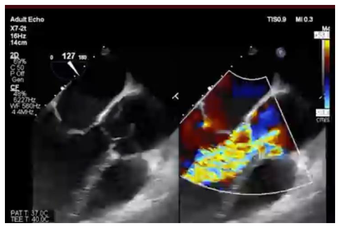 Figura da questão de Ecocardiografia