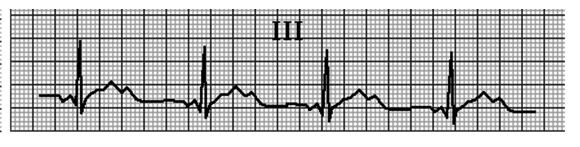 Figura da questão de Medicina (Cardiologia)