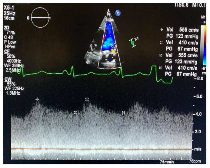 Figura da questão de Ecocardiografia