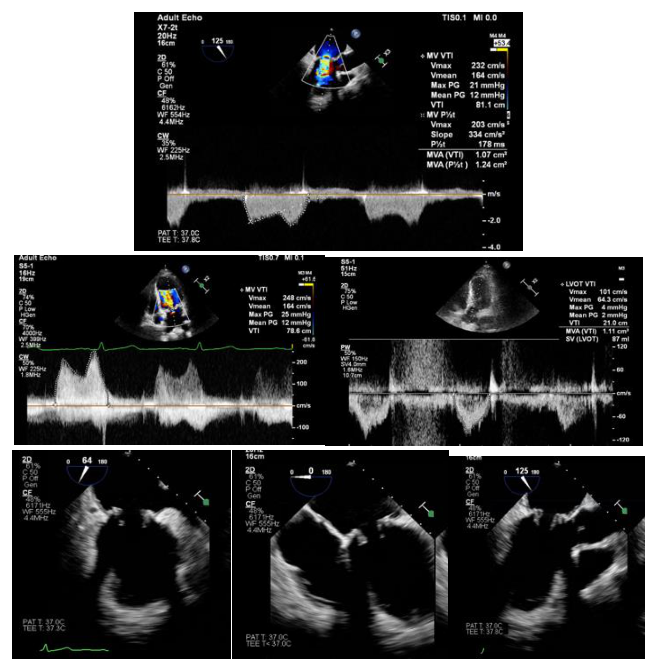 Figura da questão de Ecocardiografia
