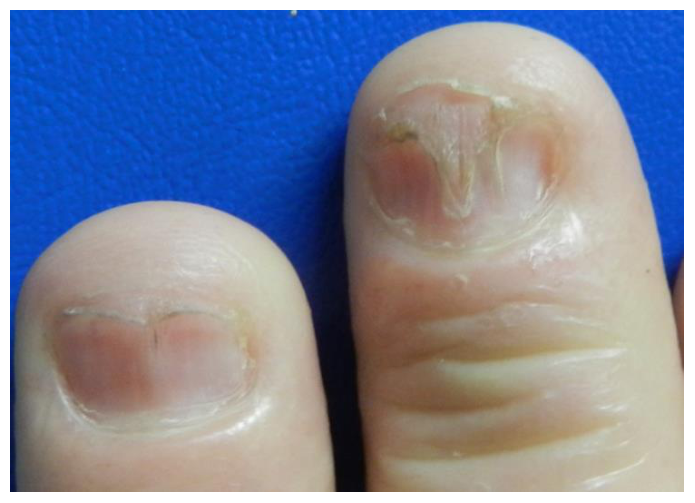 Figura da questão de Dermatologia