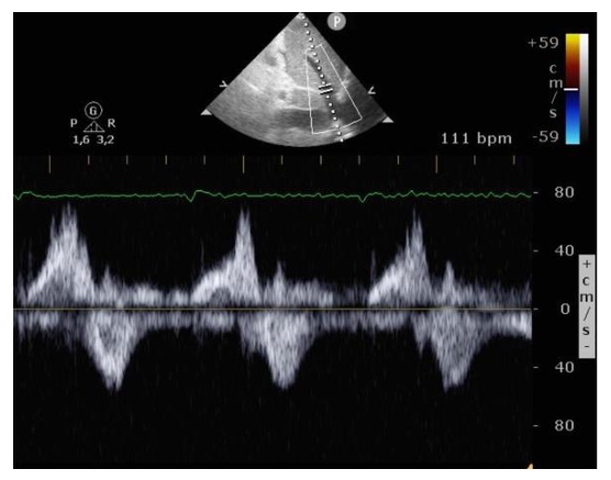 Figura da questão de Ecocardiografia