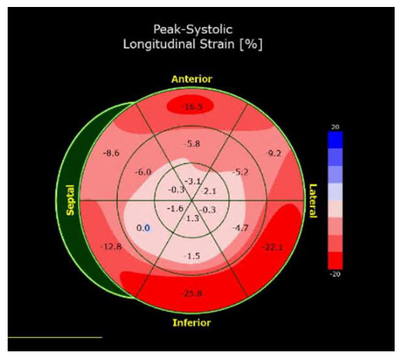 Figura da questão de Ecocardiografia