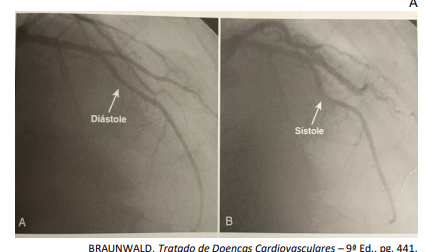 Figura da questão de Cardiologia