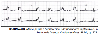 Figura da questão de Cardiologia