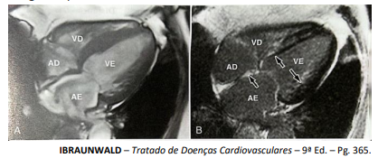 Figura da questão de Cardiologia