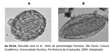 Figura da questão de Patologia Clínica