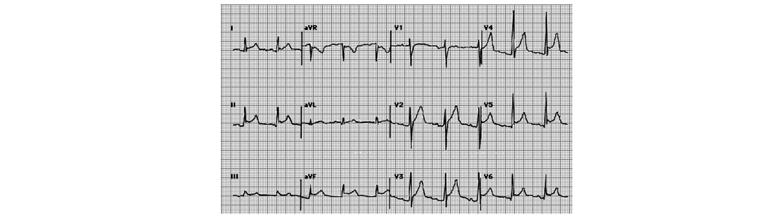 Figura da questão de Medicina (Cardiologia)
