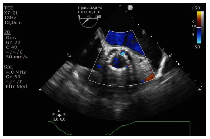 Figura da questão de Ecocardiografia
