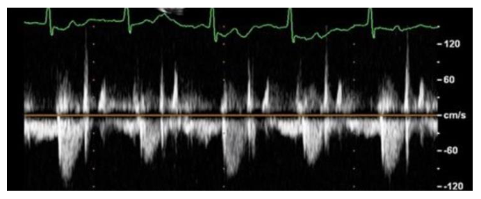 Figura da questão de Ecocardiografia