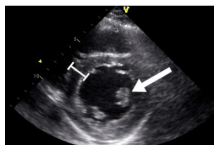 Figura da questão de Ecocardiografia