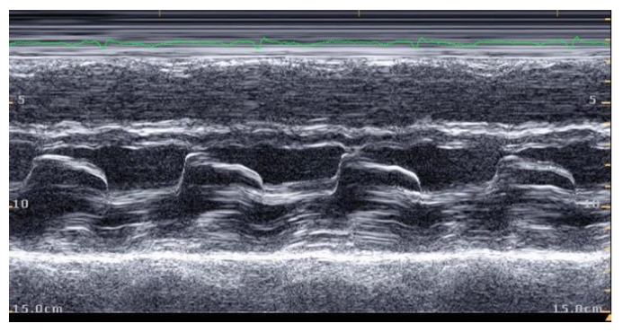 Figura da questão de Ecocardiografia