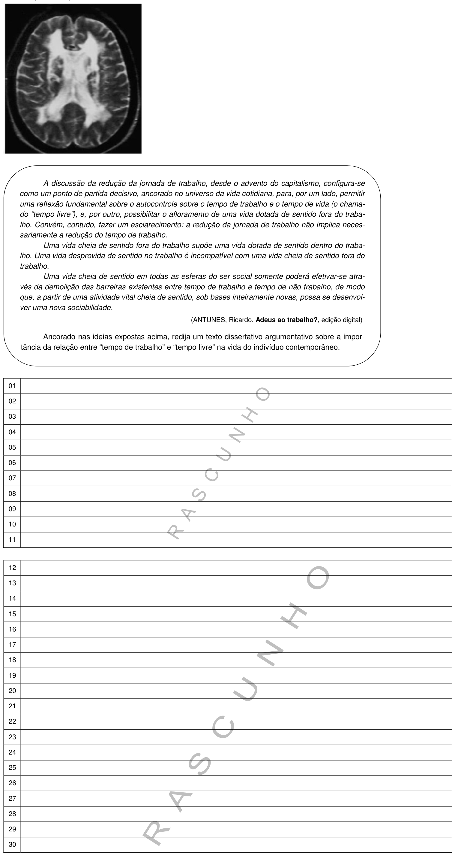 Figura da questão de Psiquiatria