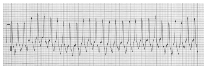 Figura da questão de Cardiologia